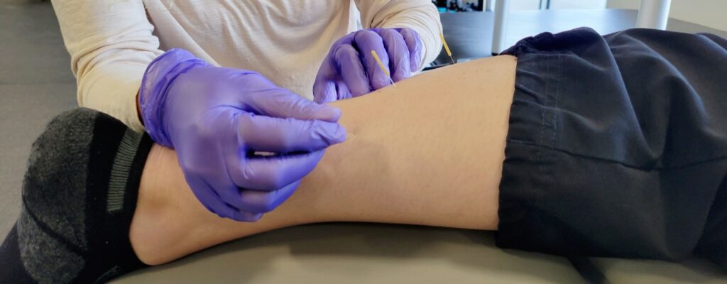 dry-needling-Integrity-Rehab-Leander-Austin-Salado-Temple-Burleson-Harker-Heights-Killeen-Copperas-Cove-TX