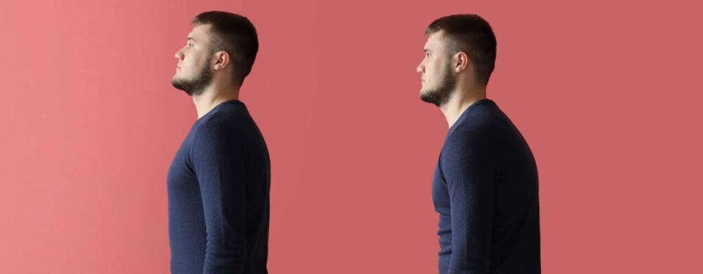 Understanding Muscle Imbalances: Causes, Effects, and Effective Physical Therapy Treatments