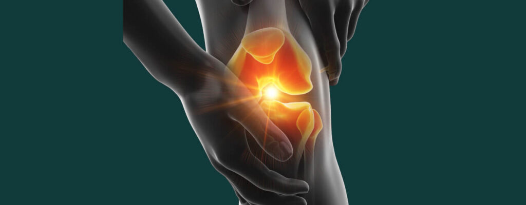 knee pain management