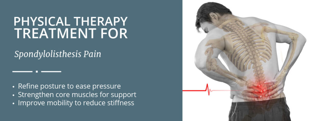 Physical Therapy Treatment for Spondylolisthesis Pain